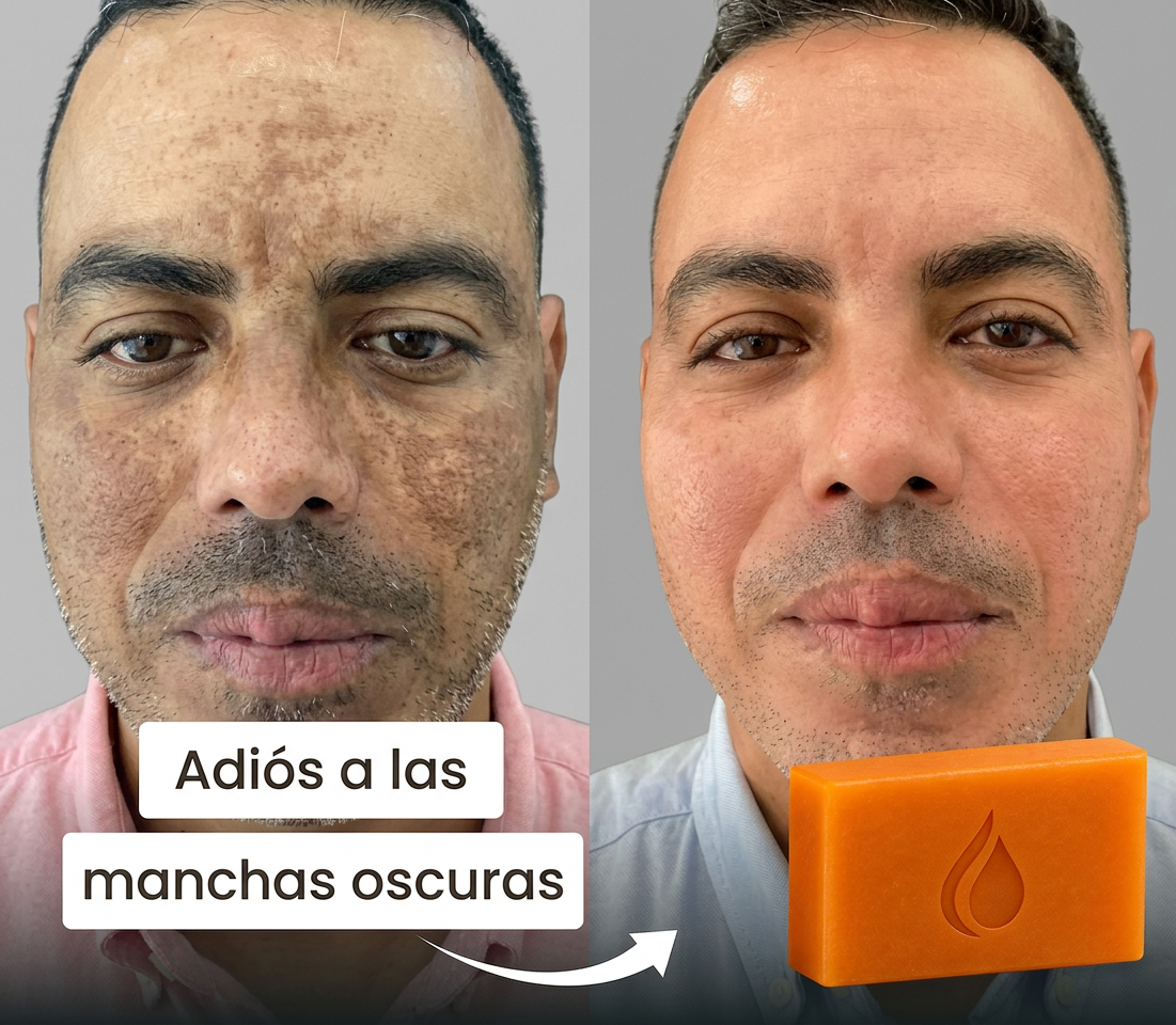 Jabón KOJIVA con Ácido Kójico