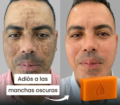 Jabón KOJIVA con Ácido Kójico